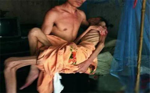 慎點!寺廟裏的晚期艾滋病人:死亡前的狀態觸