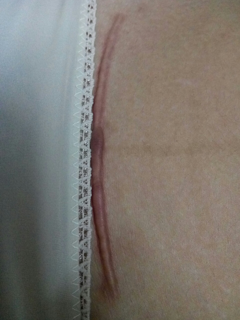 刨腹产还用看日子吗 剖腹产看了日子一定要这个日子吗?
