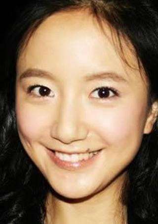 嘴臉上的痣圖解 女人面部痣相最准圖