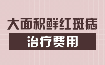 去除胎記的費用大概是多少 去胎記去醫院還是整容醫院好